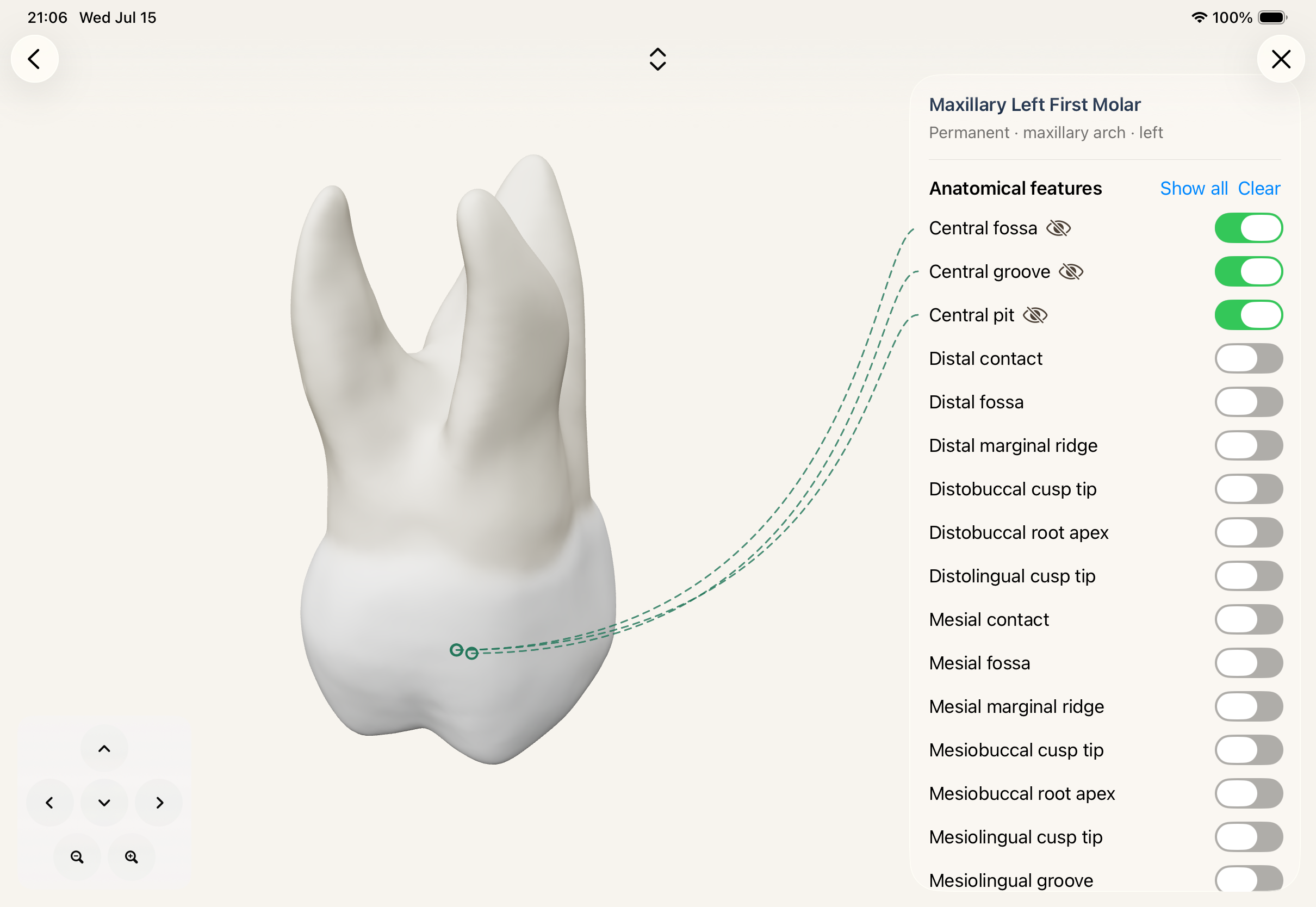 Interactive SkillsLab tooth viewer with anatomical feature controls.